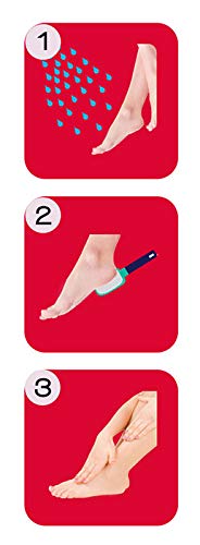 Onyx Professional Foot Rasp, No Mess Callus Remover for Feet, Includes Debris Catcher - Stainless Steel Foot Scrubber Dead Skin Remover, Lightweight Callus Shaver for Feet, Foot File, Pedicure