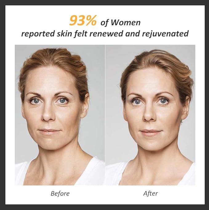 Skin Firming Facial Device, Double Effect 5-in-1Professional Home Beauty Device for Face, Neck, Arms, Abdomen, Legs, 2025 New Upgrade 5 Energy Levels - Salon Results (EP-300)