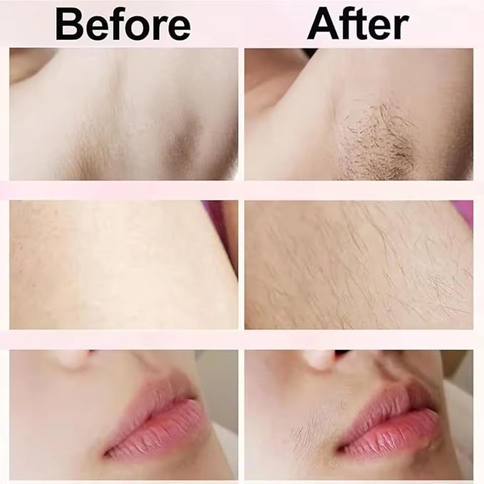 Dermave Bikini Shaver,2 in 1 Dual Head Bikini Trimmer & Body Shaver, Painless Hair Removal with Silky Glow Finish, Cordless & Waterproof Electric Trimmer for Women,Blue