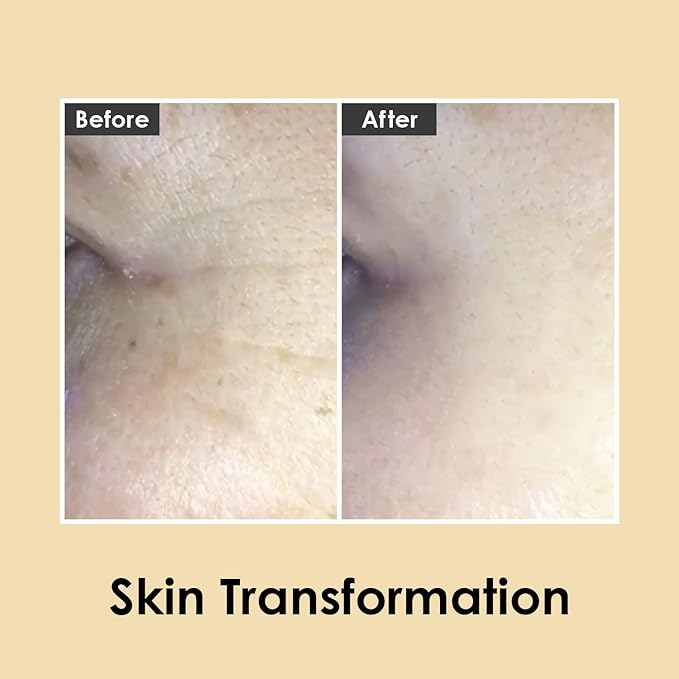 Medi-Peel Peptide9 Hyaluronic Volumy Eye Cream, Anti-Aging, Brightening, Reduces Wrinkles, Under Eye Bags, Dark Circles & Puffiness Care, Hyaluronic Acids, Enhance Elasticity, Korean Skin Care