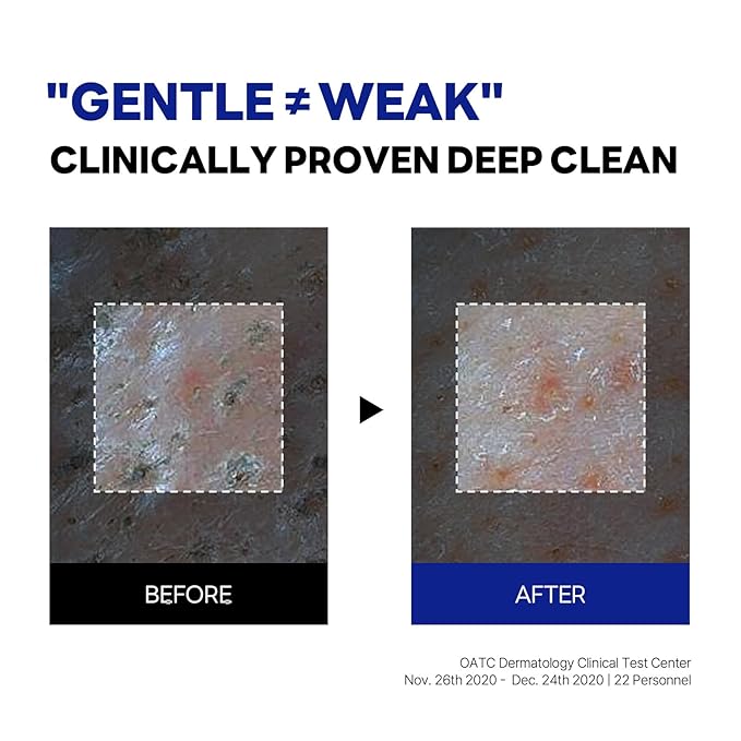 ROUND LAB Birch Juice Moisturizing Glow Eye Balm Stick + Birch Juice Moisturizing Cleanser, Hydrating Multi Balm, soothing, Low pH, Gel Type Cleanser, Korean Skincare