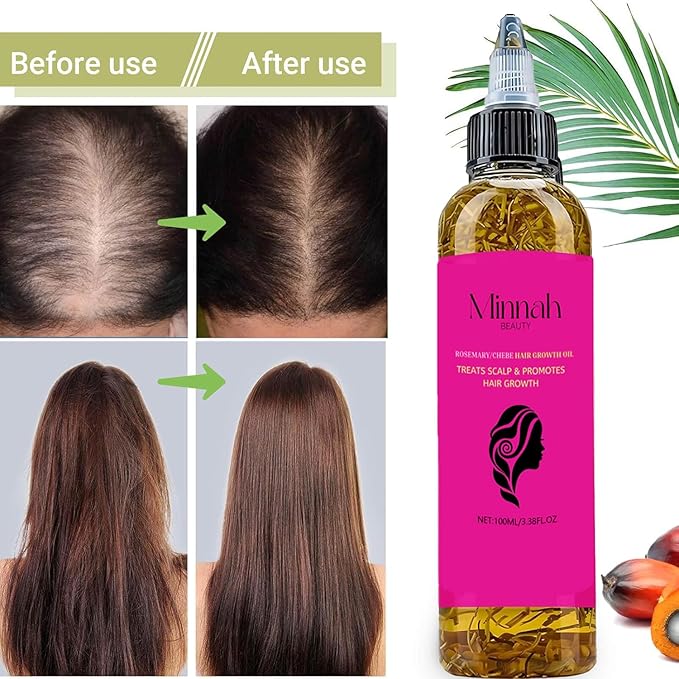 Minnah Batana Oil for Hair Growth, crack hair growth oil 4-in-1 Liquid Batana Oil, with Rosemary, Pumpkin Seed, Castor (1pcs)
