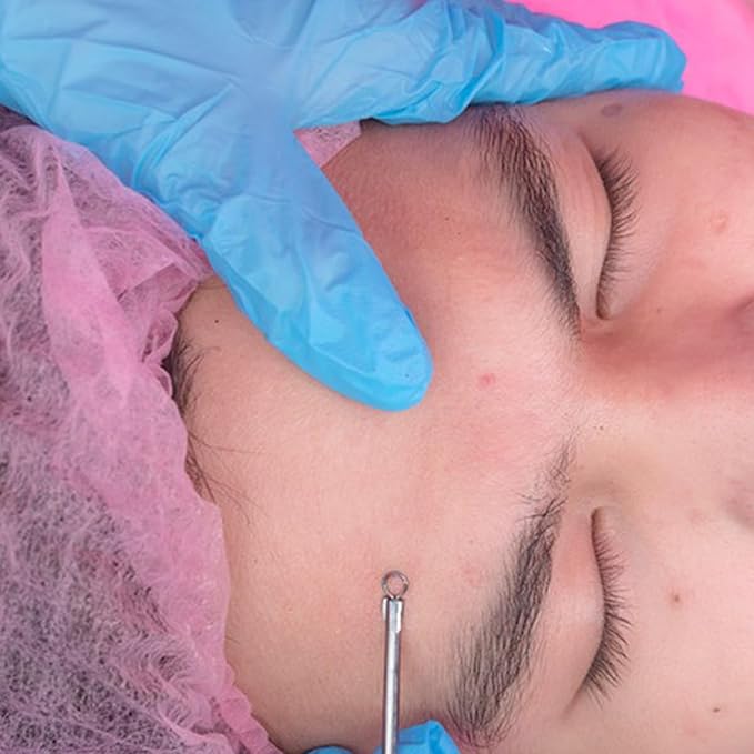 10 PCS Blackhead Remover Pimple Popper Tool Kit Blackhead Extractors Ingrown Hair Tweezers Pore Extractors Acne Treatment Tools for Clear Skin