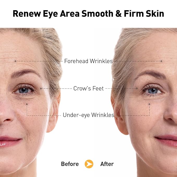 Retinol Eye Cream for Anti-Aging & Wrinkles – Firming, Hydrating & Repairing Eye Serum with Niacinamide, Hyaluronic Acid, Vitamin E & Bifida Ferment Lysate, 0.7 Fl Oz (Pack of 1)