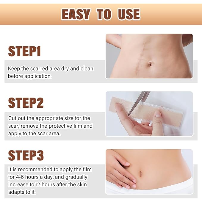 Silicone Scar Sheets,Silicone Scar Tape,Silicone Sheets