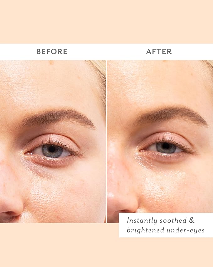 Patchology Cozy Comforts Holiday Skincare Gift Set - Soothing Under Eye Patches, Barrier-Boosting Hydrating Sheet Masks & Calming Mist - Winter Skincare Kit for Glowing Skin (Limited Edition)