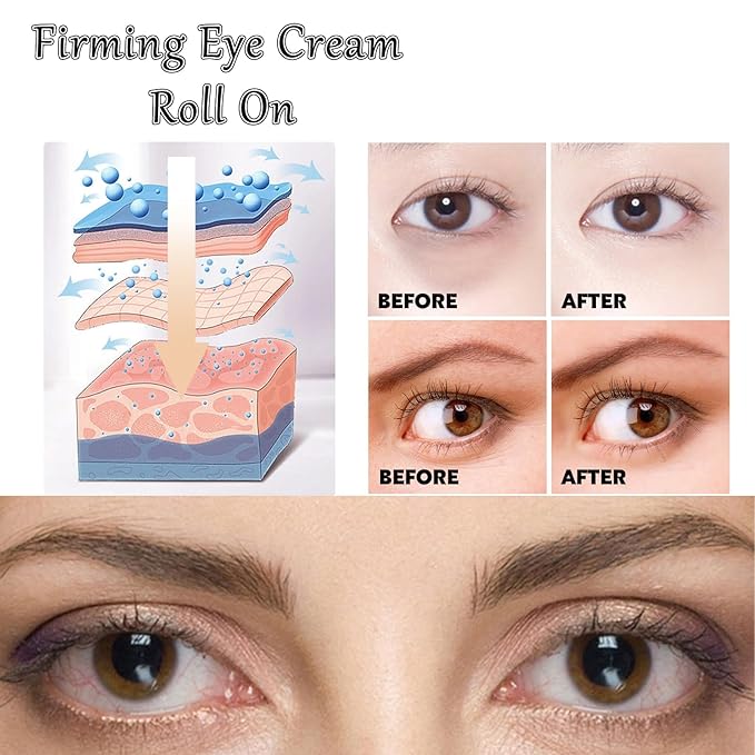 Caffeine Eye Cream Eye Serum, Under Eye Roller Cream for Dark Circles and Puffiness, 0.51 Fl Oz