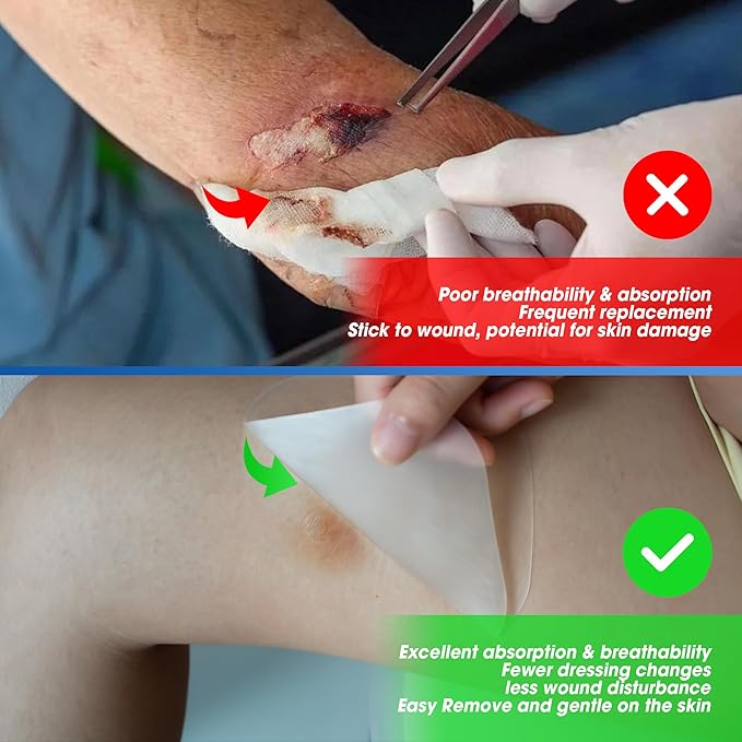 Hydrocolloid Bandages Large 4" x 4", 10 Pack Wound Dressing with Self-Adhesive, Fast Healing Patch for Bed Sore, Burn, Blister, Acne Care, Superficial Wound