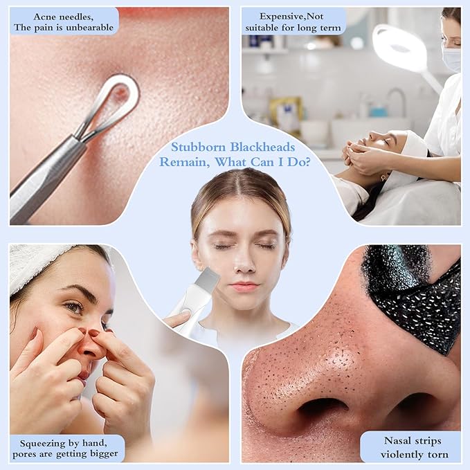 Skin Scrubber Face Spatula Skin Spatula Pore Cleaner Blackhead Remover Tools for Facial Deep Cleansing Skin Care Tool for Men and Women (White)
