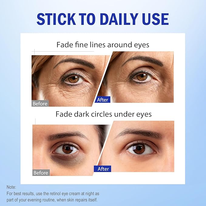 Retinol Eye Cream, Hydrating Under Eye Care Daily Wrinkle Cream, Infused with AHA30% to Smooth and Hydrate Skin, Eye Crea for Dark Circles Treatments