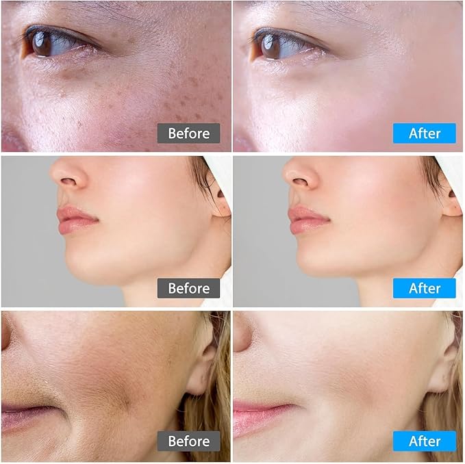 Red Light Therapy for Face, Facial Massager, Skin Care Device for Anti-Aging, at-Home, Lifting & Tightening Loose Skin (Pearl White)