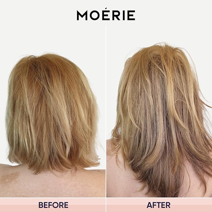 Moerie Ultimate Hair Growth Shampoo – For Longer, Thicker, Fuller Hair - Vegan Friendly Volumizing Hair Products – Paraben & Silicone Free – All Hair Types – Reverse Hair Loss – 8.45 fl oz, Triple Set