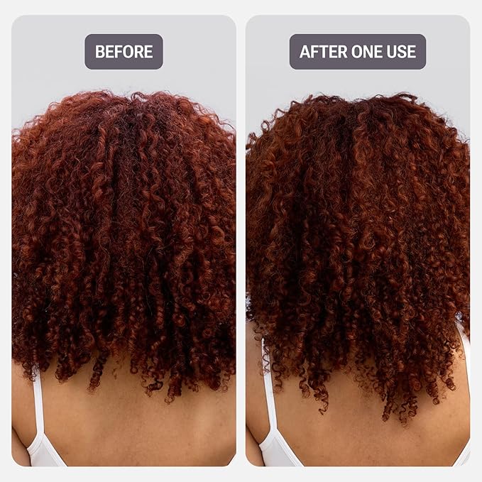 NULASTIN Strength & Shine Hair Duo - Vibrant Scalp Shampoo (10 fl oz) & Vibrant Scalp Conditioner (10 fl oz) - Reduce Frizz, Enhance Volume, and Support Hair Growth (2 Pc)