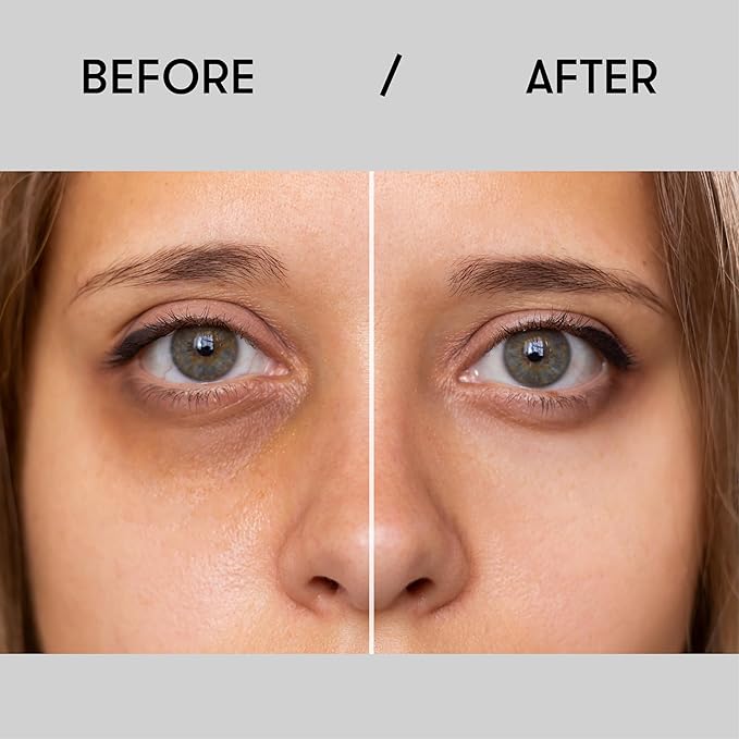 Sane Eye Cream for Dark Circles and Puffiness Treatment with Caffeine and Niacinamide - 0.68 fl oz, Hydrating Eye Cream for Dark Circles, Mornings without Puffiness