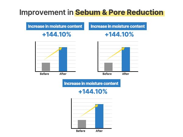 S.NATURE AQUA SQUALANE SERUM | Deeply hydrated Facial Serum for All Skin Type, Soothing, Pore Tightening and Sebum control Benefits, Korean Skin Care (1.69 Fl.Oz)