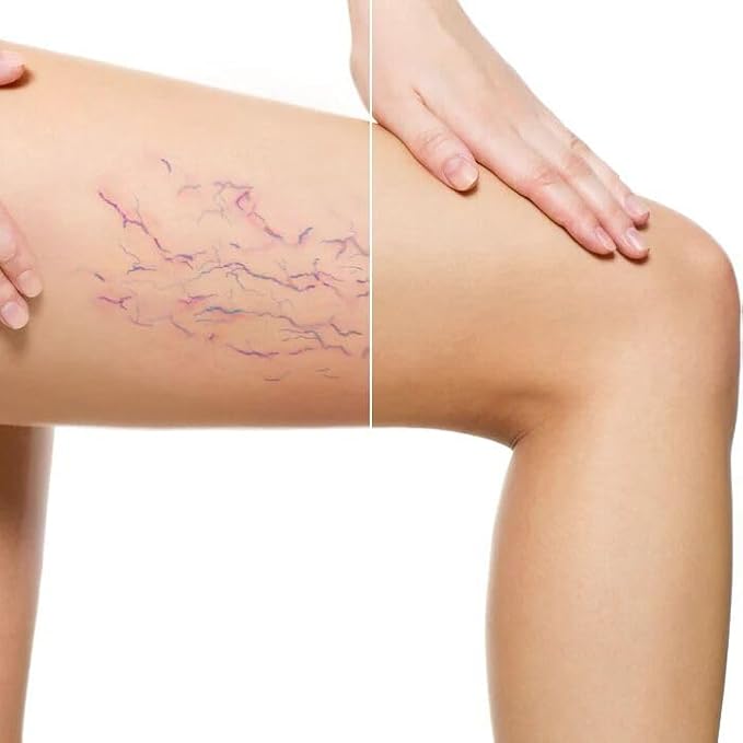 LUMINESS Airbrush Body Coverage - Tattoo Cover Up Makeup - Full Coverage Foundation for Face & Body - Water-Resistant, Long-Wear, Natural Radiant Finish, Light Medium