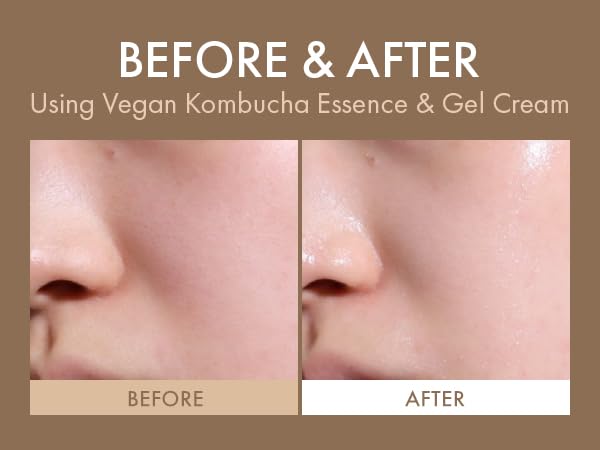 Dr.Ceuracle Vegan Kombucha Tea Gel Cream - Korean Skincare Lightweight Watery Hydrating Moisturizer with Kombucha Tea Extract, Sunflower Seed Oil (75g / 2.64 oz.)