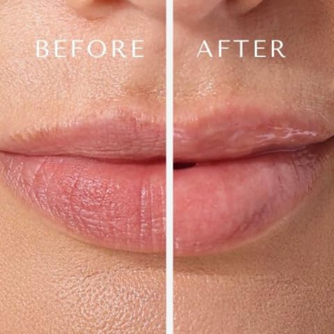 EpicLight Lip Flip Treatment Balm - Sulfate-free,