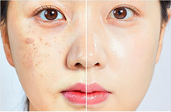 (85%) Human Stem Cell & (10%) PDRN Anti-Aging & Repair Ampoule Serum (12 Vials, 120ml) for Youthful, Radiant Skin!