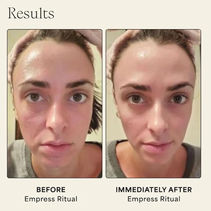 WILDLING Empress Platinum Gua Sha | Facial Gua Sha | Stainless Steel | Maximium Lifting + Sculpting + Contouring + Toning + De-Puffing