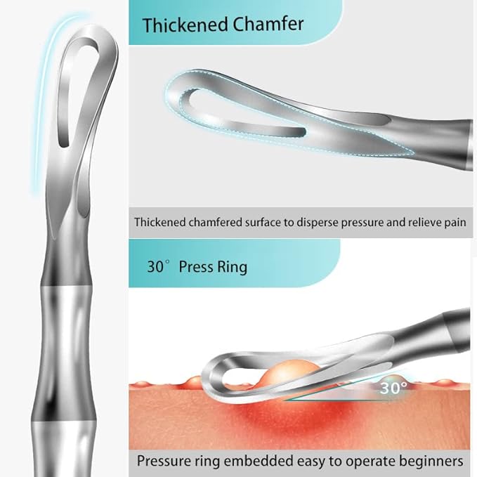 2Pcs Professional Facial Blackhead Remover Tweezers and Pimple Extractor Acne Treatment Tool for Acne Pimples Comedowns Blemishes or Splinters Removal