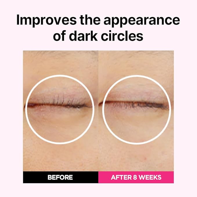 ISOI Blemish Care Up Facial Serum Triple Set, Korean Skin Care Set for Glass Skin Radiance, 2 Full Size & 1 Refill, Eye & Wrinkle Patch Tester, Daily Hydration Skincare Gift for Women (2.13 fl. oz)