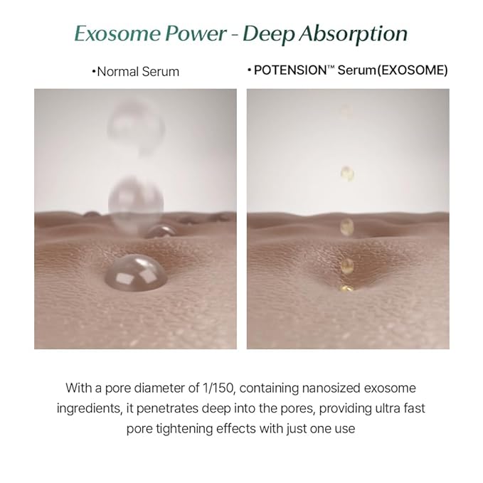 CELORABY Potension Pore Tightening Boost Serum - Advanced Korean Skincare Pore Minimizer with Exosome Technology, Targets Excess Sebum & Impurities (1.01 fl.oz)