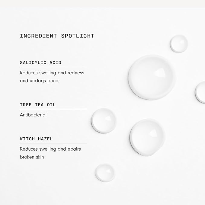 Versed Back-Up Acne Control Body Mist - All Over Blemish Spot Treatment + Salicylic Acid Spray with Tea Tree Oil & Witch Hazel - Oil Control + Redness Relief Acne Spray for Back & Body - Vegan (3 oz)