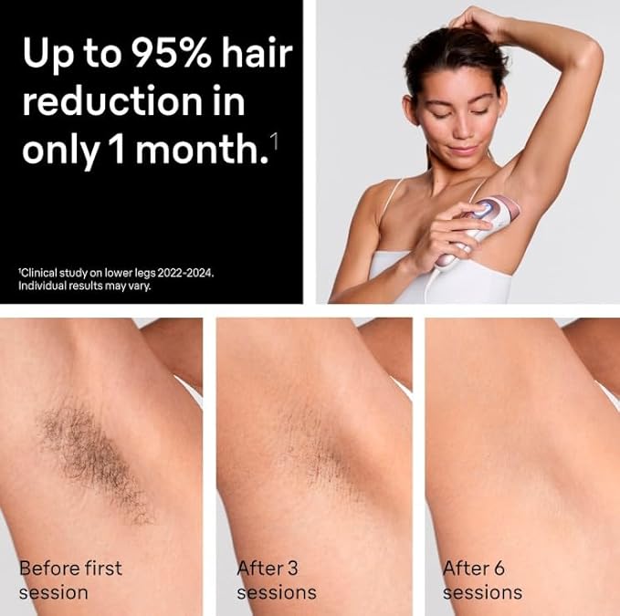 Braun Smart IPL, Silk·Expert Pro 5: at Home Laser Hair Removal for Women and Men, Permanent Visible Hair Reduction in Hair Regrowth for Body & Face, Wide Head and Two Precision Heads, IPL5347