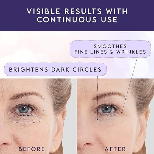 Eye Cream for Dark Circles and Puffiness 2 packs – Under Eye Balm Stick with Caffeine – Eye Brightener Stick for Eye Bags, Wrinkles, Fine Lines –