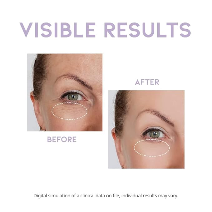 Eye cream for dark circles