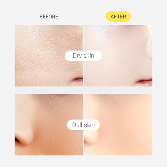 TENZERO Intense Bubble Toner, 4.73 fl oz/140ml, Hydrating & Exfoliating Bubble Toner for Face, Glowing Anti-Aging, Radiant Complexion & Skin Elasticity