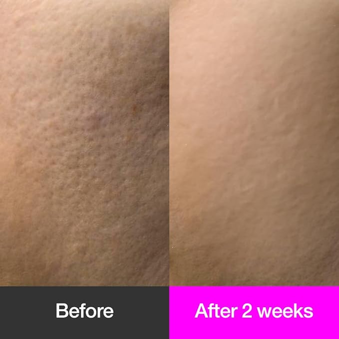 Black Cherry Pore Tightening Cream Luftig, Pore Minimizer, Black Cherry Extract, AHA, Hydrolyzed Collagen, Korean Skincare, All Skin Types, 3.3 fl.oz / 100ml