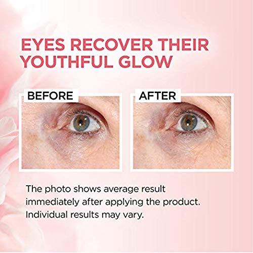 Eye brightener eye cream skin