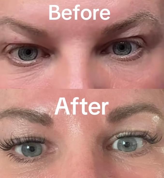 Intoxicated Cosmetics Snake Eyes Eye Serum 15 ml - Bakuchiol Under Eye Solution for Women and Men - Lift | Tighten | Brighten