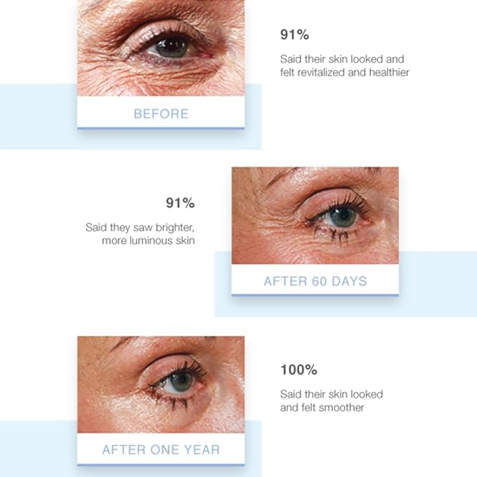 Elevate Eye Creme - With Age Defying Growth Factors Formulated To Address The Appearance Of Fine Lines And Wrinkles