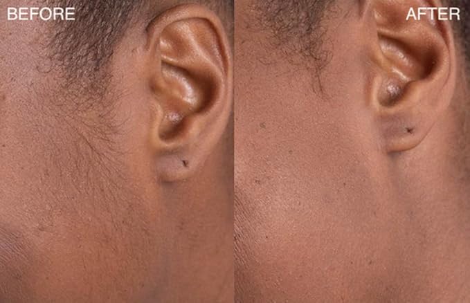 Starter Kit - 3 Pack Dermaplaning Razors & Aloe Vera Shave Gel - Dermaplane Razor - Eyebrow Razor - Dermaplaning tool for Face - Facial Razor for Women - Peach Face Remover