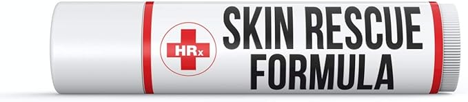 Skin Rescue Formula (Herp Stop Discreet) oz