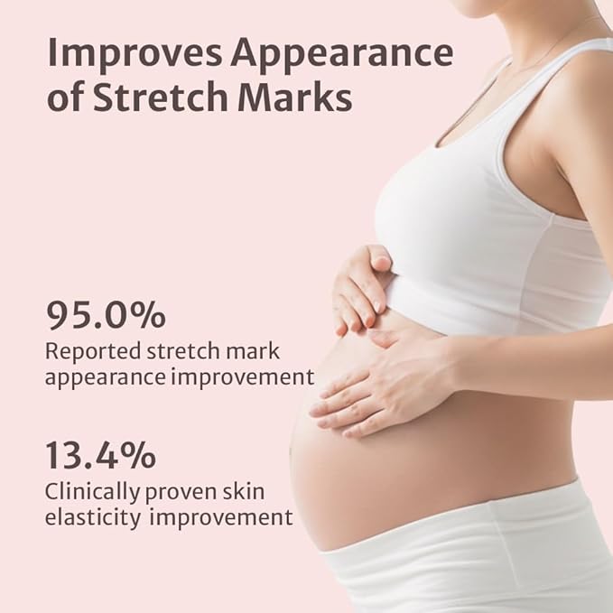Pregnancy-Safe Advanced Stretch Mark Cream for Maternity - Korean Skincare - Elasticity Boost Formula with Panthenol & Allantoin - Clinical Grade Clean & Vegan - 6.76 fl oz