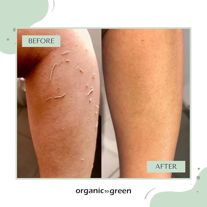 Organic to Green Premium Exfoliating Mitt for Body (2pc) – 100% Vegan Viscose Traditional Body Scrub Washcloth – Body Exfoliator (Green)