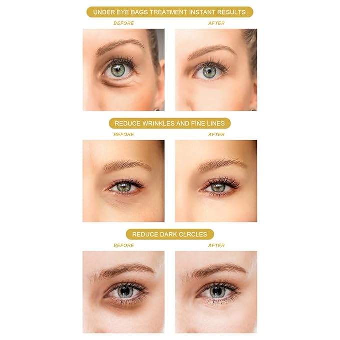 Under Eye Patches with Aloe Vera Natural for Dark Circles and Puffiness, Hyaluronic Acid Eye Mask 60 Pieces Moisturizing Skin Care for Anti-Wrinkle