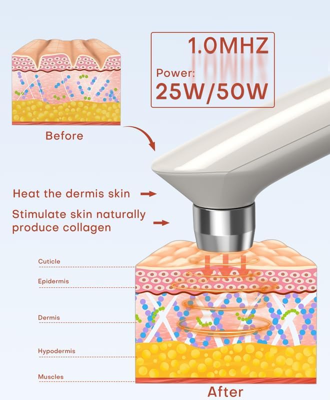 MLAY Professional RF Beauty Machine, Radio Frequency Face Machine with 2 Probes, at Home Radio Frequency Skin Tightening for Lifting, Wrinkle Reducing, Anti Aging - Salon Effects（Gel Included）
