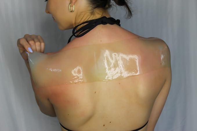 Aloe Wrap for Sunburn Relief – New Hydro-Gel After Sun Organic Aloe Skin Treatment for Long-Lasting Relief from Pain, Itching, and Peeling. Made in The USA with 100% certified organic Aloe