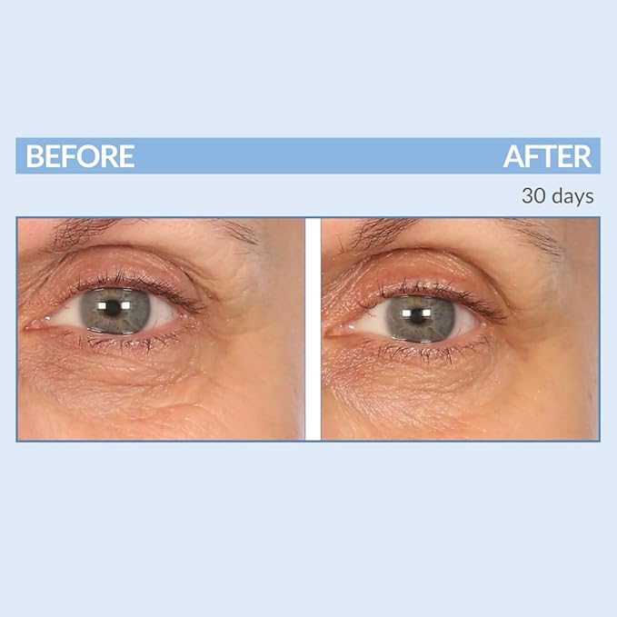 Serious Skincare - Eyetality PM Total Eye Care - Evening Night Eye Cream with Lash Boosting Peptides for Thicker, Longer Lashes - 0.5 oz.