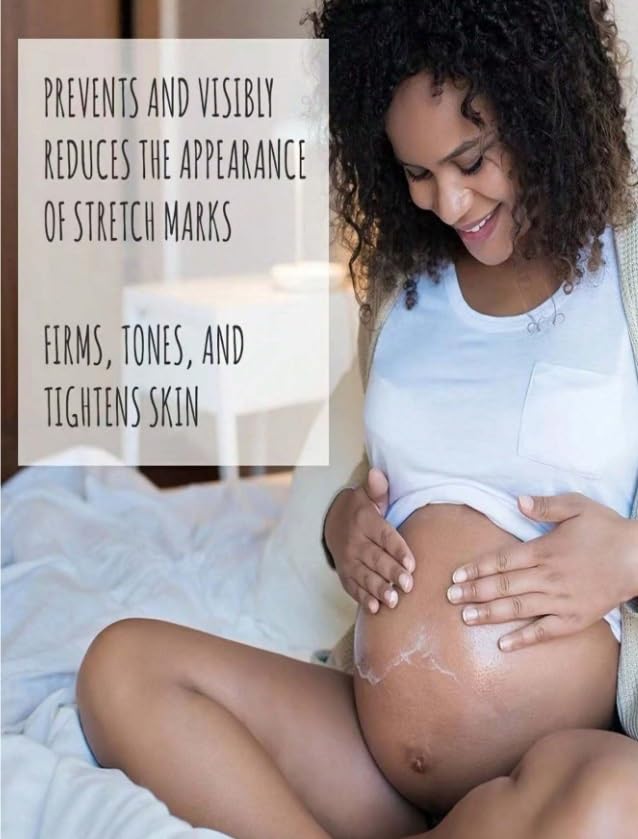 TRSTAY Stretch Mark Treatment Stretch Mark Cream (50, Grams)