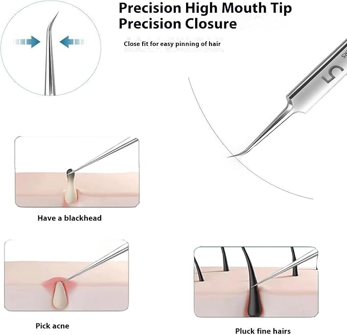 10 Pcs Acssart Blackhead Remover Tools, Acssart Stainless Steel Blackhead Remover Kit, Pimple Popper Tool Kit, Blackhead Tweezers with 15x Magnifying Glass, Metal Case