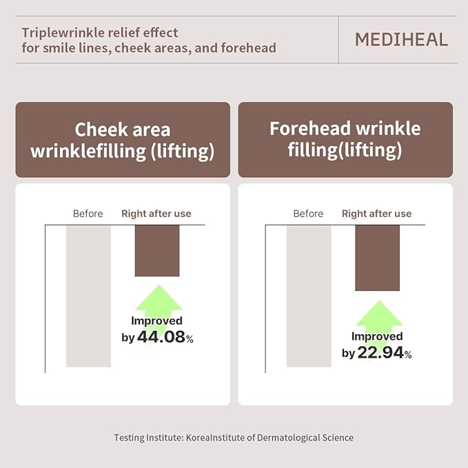 Mediheal Retinol Collagen Cream Lifting Mask (10 Counts) for V Line Mask, Anti-Aging - Helps Reduce Fine Lines & Wrinkles, and Smoothens Skin
