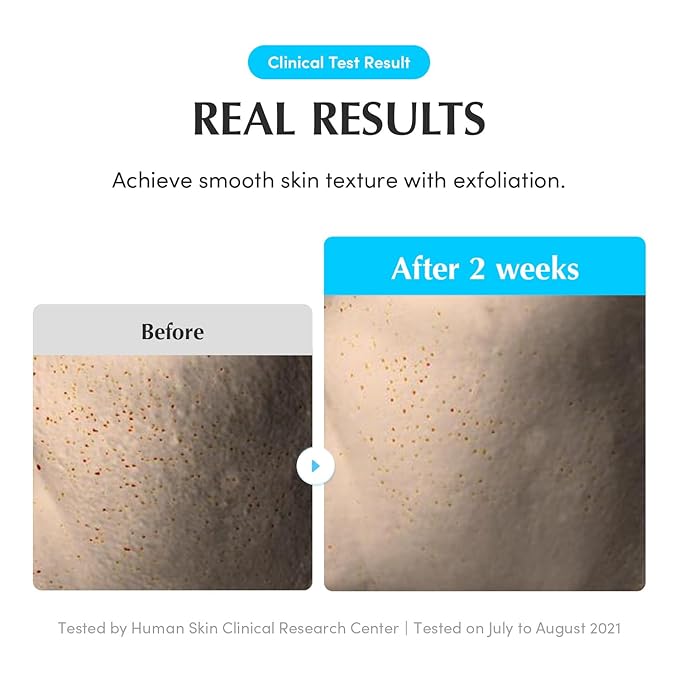 EQQUALBERRY Swimming Pool Toner - Korean Toner for Daily Exfoliating & Deep Hydration with Natural Enzyme Protease & Hyaluronic Acid, For Sensitive Skin, 10.14 Fl Oz (300ml)