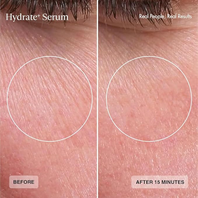 Senté Hydrate+ Serum | Hyaluronic Acid with HSA for Glass Skin | Deep Hydration & Barrier Support | Fast-Absorbing | Calms & Soothes | Paraben, Cruelty, Fragrance Free | 1.0 oz
