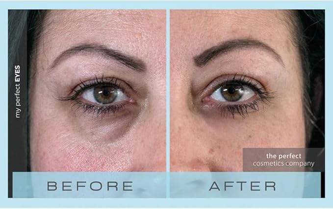 My Perfect Eyes 10ml, 100 Applications, Penny Lane, Instant Results, Clinically Proven, Anti-Ageing Serum UK Original Formula, Science-Backed Anti-Wrinkle Serum. As Seen on TV.